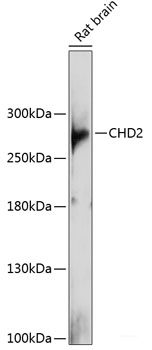 Western blot analysis of extracts of various cell lines using PSME2 Polyclonal Antibody at dilution of 1:1000.