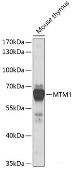 Immunohistochemistry of paraffin-embedded Human colon using DEFB132 Polyclonal Antibody at dilution of  1:100 (40x lens).