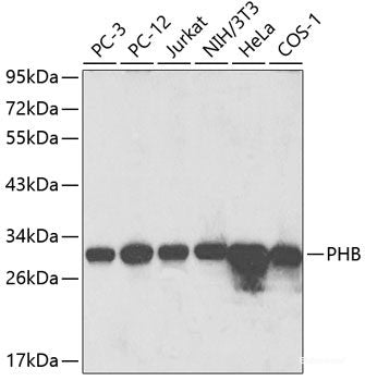 Immunofluorescence analysis of C6 cells using TNFAIP8L2 Polyclonal Antibody at dilution of  1:100. Blue: DAPI for nuclear staining.