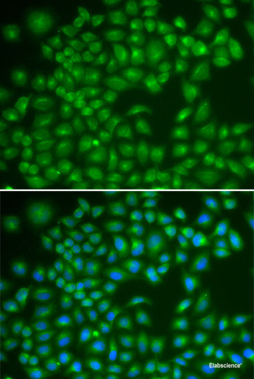 Immunofluorescence analysis of L929 cells using CYP17A1 Polyclonal Antibody at dilution of  1:100. Blue: DAPI for nuclear staining.