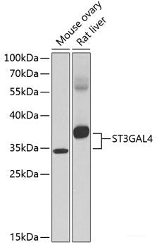 Western blot analysis of extracts of 293T cells using ADAP2 Polyclonal Antibody at dilution of 1:3000.