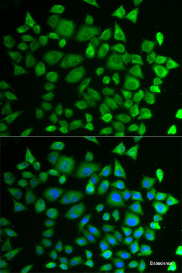 Immunohistochemistry of paraffin-embedded Mouse brain using OGG1 Polyclonal Antibody at dilution of  1:200 (40x lens).