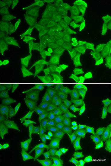 Immunohistochemistry of paraffin-embedded Mouse kidney using AQP5 Polyclonal Antibody at dilution of  1:50 (40x lens).