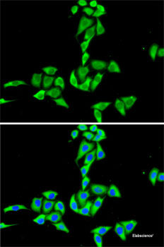Immunofluorescence analysis of HeLa cells using TIMP1 Polyclonal Antibody at dilution of  1:100. Blue: DAPI for nuclear staining.