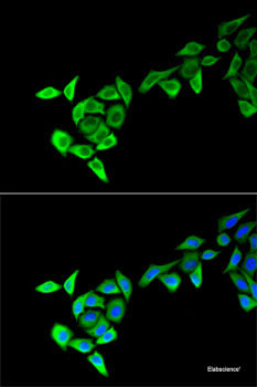Immunohistochemistry of paraffin-embedded Human lung cancer using PAX3 Polyclonal Antibody at dilution of  1:100 (40x lens).