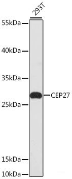 Immunohistochemistry of paraffin-embedded Rat spleen using CEBPE Polyclonal Antibody at dilution of  1:100 (40x lens).
