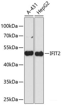 Immunofluorescence analysis of U2OS cells using ITPR1 Polyclonal Antibody at dilution of  1:100. Blue: DAPI for nuclear staining.