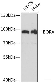 Immunohistochemistry of paraffin-embedded Rat brain using RPL3 Polyclonal Antibody at dilution of  1:100 (40x lens).