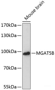 Immunohistochemistry of paraffin-embedded Human kidney using ZNF264 Polyclonal Antibody at dilution of  1:100 (40x lens).