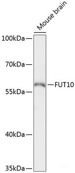 Immunofluorescence analysis of HeLa cells using AKAP5 Polyclonal Antibody at dilution of  1:100. Blue: DAPI for nuclear staining.