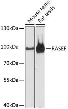Immunofluorescence analysis of U2OS cells using IGF2BP2 Polyclonal Antibody at dilution of  1:100. Blue: DAPI for nuclear staining.