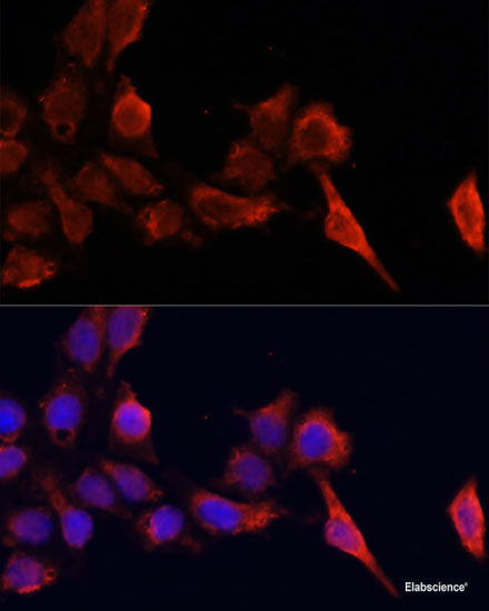 Immunohistochemistry of paraffin-embedded Human prostate using PSAT1 Polyclonal Antibody at dilution of  1:100 (40x lens).