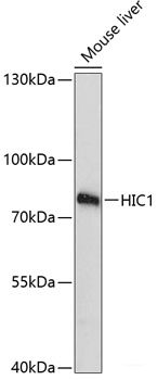 Confocal immunofluorescence analysis of U2OS cells using NOP58 Polyclonal Antibody at dilution of  1:100. Blue: DAPI for nuclear staining.