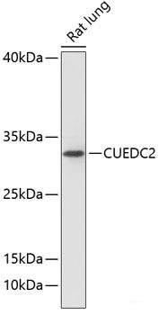 Immunofluorescence analysis of Human breast using RNF31 Polyclonal Antibody at dilution of  1:100 (40x lens). Blue: DAPI for nuclear staining.