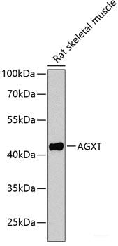 Immunohistochemistry of paraffin-embedded Human liver damage using NRF1 Polyclonal Antibody at dilution of  1:100 (40x lens).
