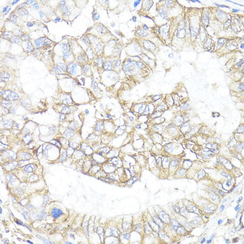 Immunohistochemistry of paraffin-embedded Rat kidney using GNAI2 Polyclonal Antibody at dilution of  1:100 (40x lens).