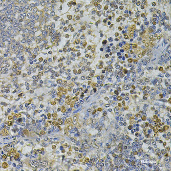 Immunofluorescence analysis of HeLa cells using CYP3A4 Polyclonal Antibody at dilution of  1:100 (40x lens). Blue: DAPI for nuclear staining.