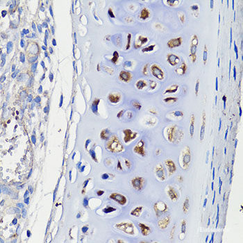 Immunofluorescence analysis of NIH/3T3 cells using UBIAD1 Polyclonal Antibody at dilution of  1:100. Blue: DAPI for nuclear staining.