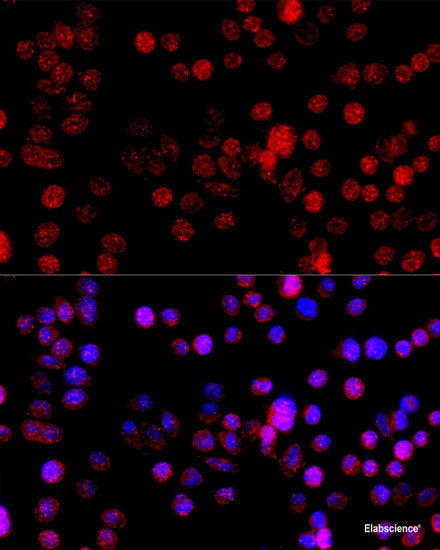 Immunohistochemistry of paraffin-embedded Rat lung using VASP Polyclonal Antibody at dilution of  1:100 (40x lens).