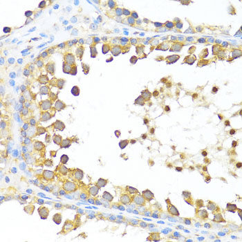 Immunohistochemistry of paraffin-embedded Human appendix using Acetyl-Histone H4-K12 Polyclonal Antibody at dilution of  1:200 (40x lens).