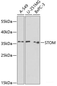 Immunohistochemistry of paraffin-embedded Human skin using CDH3 Polyclonal Antibody at dilution of  1:100 (40x lens).