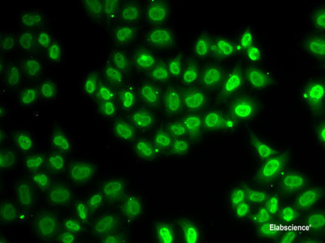 Immunohistochemistry of paraffin-embedded Rat testis using CREBBP Polyclonal Antibody at dilution of  1:100 (40x lens).