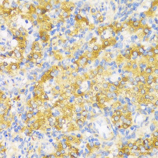 Immunofluorescence analysis of C6 cells using JAG2 Polyclonal Antibody at dilution of  1:100. Blue: DAPI for nuclear staining.