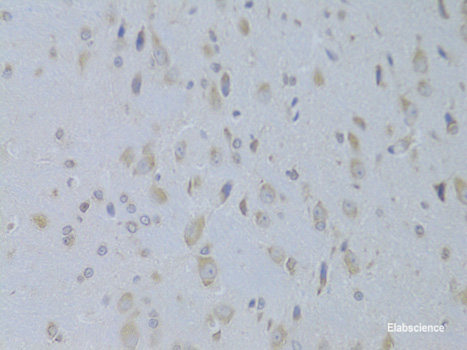 Immunofluorescence analysis of Human colon carcinoma cells using TNFRSF25 Polyclonal Antibody at dilution of  1:100. Blue: DAPI for nuclear staining.