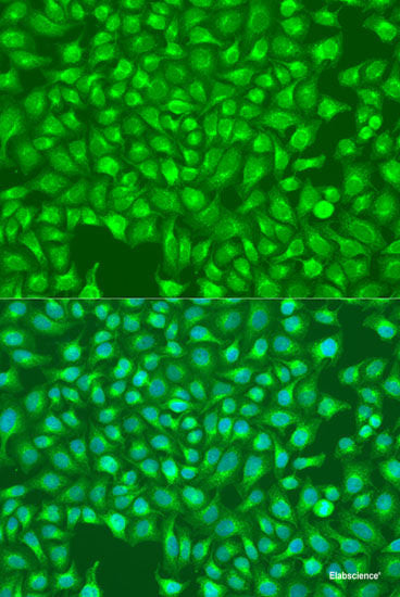 Immunofluorescence analysis of NIH-3T3 cells using VPS26A Polyclonal Antibody at dilution of  1:100 (40x lens). Blue: DAPI for nuclear staining.