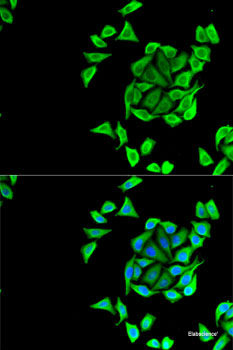 Immunohistochemistry of paraffin-embedded Rat pancreas using DLL1 Polyclonal Antibody at dilution of  1:100 (40x lens).