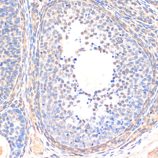 Immunohistochemistry of paraffin-embedded Human lung using CAND1 Polyclonal Antibody at dilution of  1:100 (40x lens).