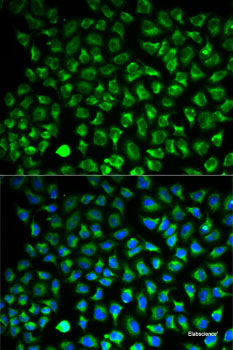 Immunofluorescence analysis of C6 cells using NDUFA4L2 Polyclonal Antibody at dilution of  1:100. Blue: DAPI for nuclear staining.