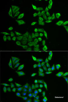 Immunohistochemistry of paraffin-embedded Human colon using CCDC124 Polyclonal Antibody at dilution of  1:100 (40x lens).