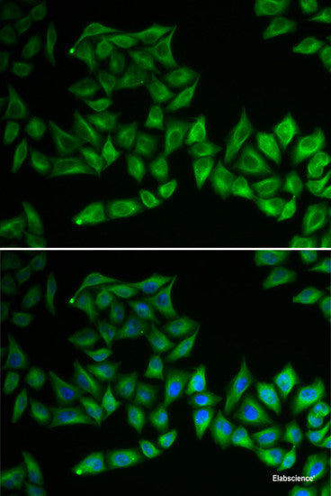 Immunofluorescence analysis of C6 cells using RPL36AL Polyclonal Antibody at dilution of  1:100 (40x lens). Blue: DAPI for nuclear staining.