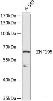 Immunofluorescence analysis of Human placenta using LAIR2 Polyclonal Antibody at dilution of  1:100. Blue: DAPI for nuclear staining.