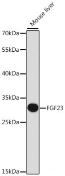 Immunofluorescence analysis of L929 cells using NDUFB3 Polyclonal Antibody at dilution of  1:100 (40x lens). Blue: DAPI for nuclear staining.