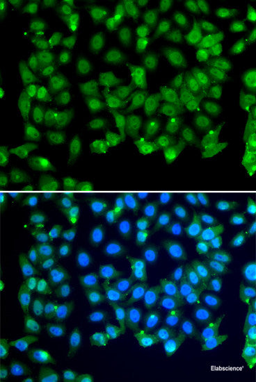 Immunohistochemistry of paraffin-embedded Human appendix using ACOT2 Polyclonal Antibody at dilution of  1:100 (40x lens).