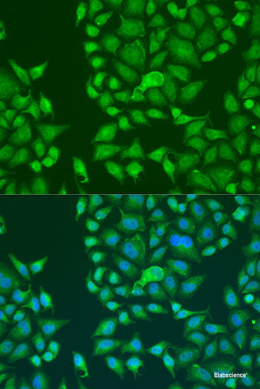 Immunohistochemistry of paraffin-embedded Mouse pancreas using PDP2 Polyclonal Antibody at dilution of  1:100 (40x lens).