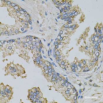 Immunohistochemistry of paraffin-embedded Rat adrenal gland using CYP11B2 Polyclonal Antibody at dilution of  1:100 (40x lens).