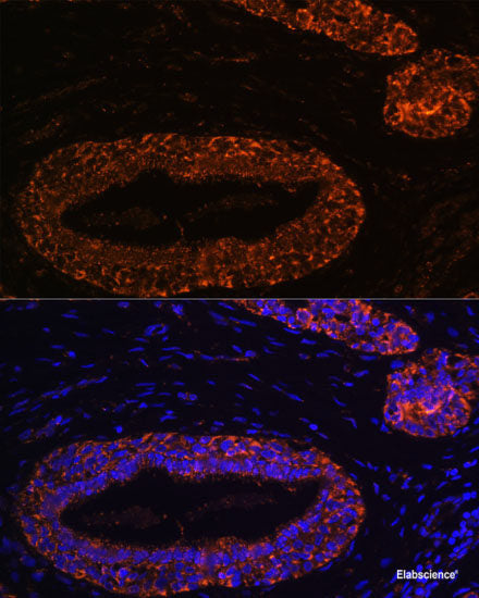 Immunohistochemistry of paraffin-embedded Rat testis using ASZ1 Polyclonal Antibody at dilution of  1:100 (40x lens).
