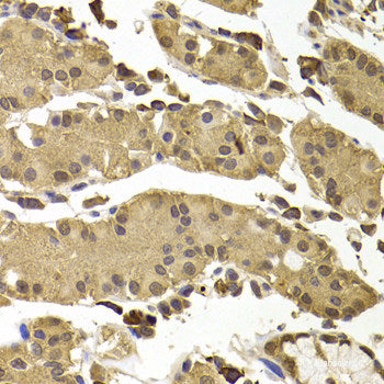 Immunofluorescence analysis of C6 cells using UBQLNL Polyclonal Antibody at dilution of  1:100. Blue: DAPI for nuclear staining.