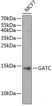 Immunohistochemistry of paraffin-embedded Human appendix using TPSAB1 Polyclonal Antibody at dilution of  1:100 (40x lens).