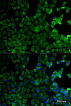 Immunohistochemistry of paraffin-embedded Human stomach using CAMK1 Polyclonal Antibody at dilution of  1:100 (40x lens).