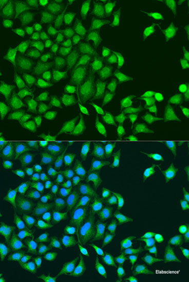 Immunohistochemistry of paraffin-embedded Human stomach using AHR Polyclonal Antibody at dilution of  1:100 (40x lens).