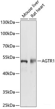 Immunofluorescence analysis of C6 cells using SMYD3 Polyclonal Antibody at dilution of  1:100. Blue: DAPI for nuclear staining.