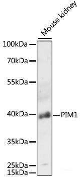 Immunofluorescence analysis of C6 cells using FLCN Polyclonal Antibody at dilution of  1:100. Blue: DAPI for nuclear staining.