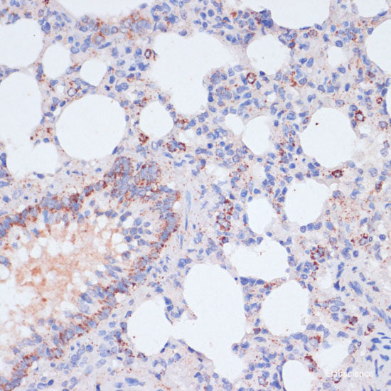 Immunofluorescence analysis of C6 cells using DNASE1 Polyclonal Antibody at dilution of  1:100 (40x lens). Blue: DAPI for nuclear staining.