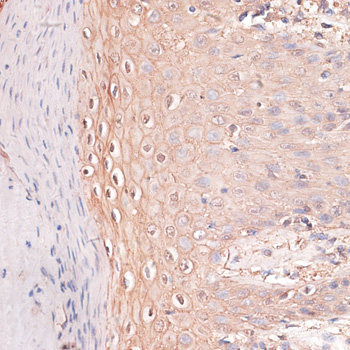 Immunofluorescence analysis of C6 cells using GNAI2 Polyclonal Antibody at dilution of  1:100 (40x lens). Blue: DAPI for nuclear staining.