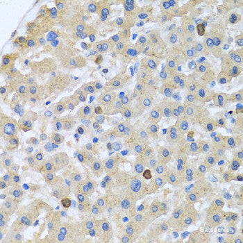 Immunofluorescence analysis of C6 cells using DPP4 Polyclonal Antibody at dilution of  1:100. Blue: DAPI for nuclear staining.