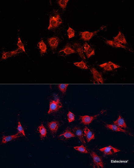 Immunohistochemistry of paraffin-embedded Rat brain using SLC37A4 Polyclonal Antibody at dilution of  1:100 (40x lens).